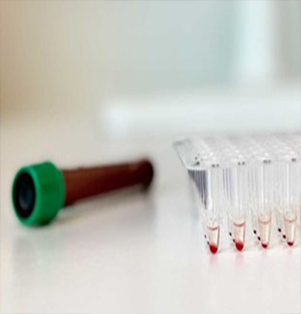 Hemolysis Assay