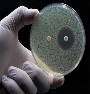 Antibacterial Inhibition Zone